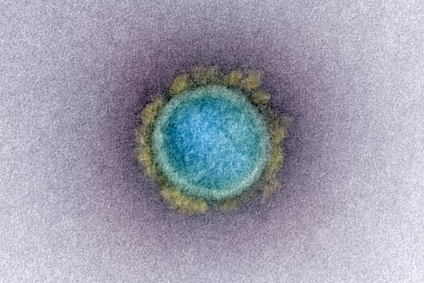כמה מחשבות על וירוס הקורונה